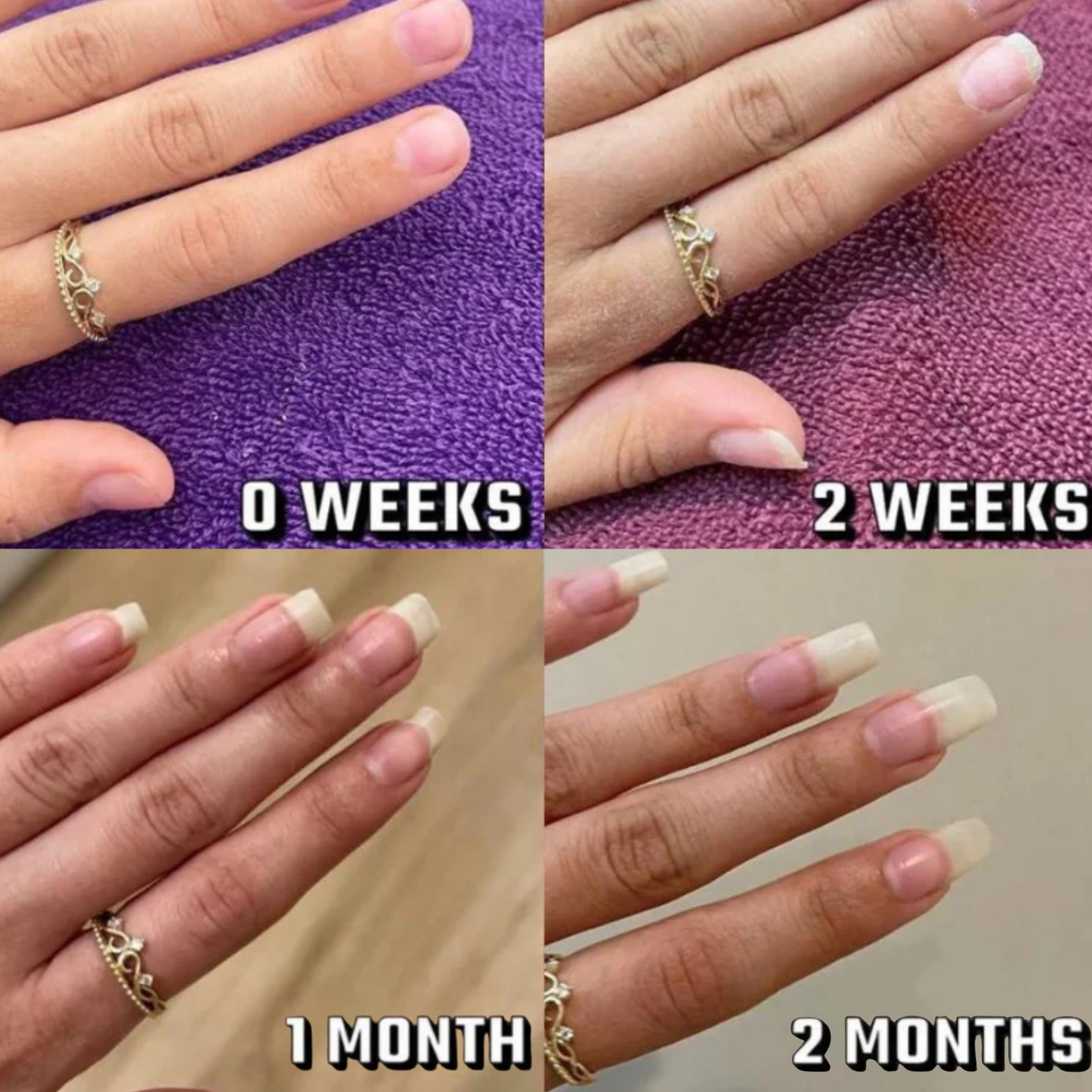 Revolutionary Stem Cell Nail Growth Treatment Pen for Stronger Healthier Nails™