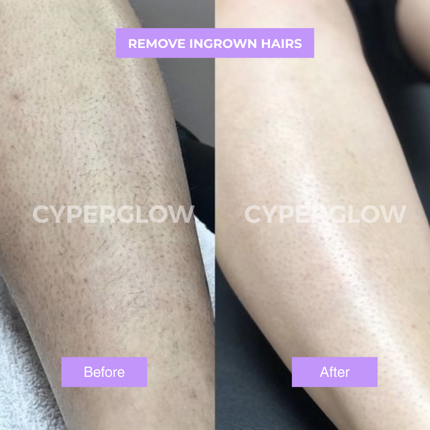 CyperGlow™ Premium Cyperus Rotundus Skin Serum For Radiant Glow
