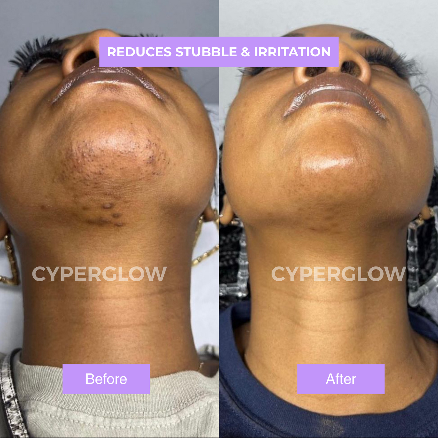 CyperGlow™ Premium Cyperus Rotundus Skin Serum For Radiant Glow