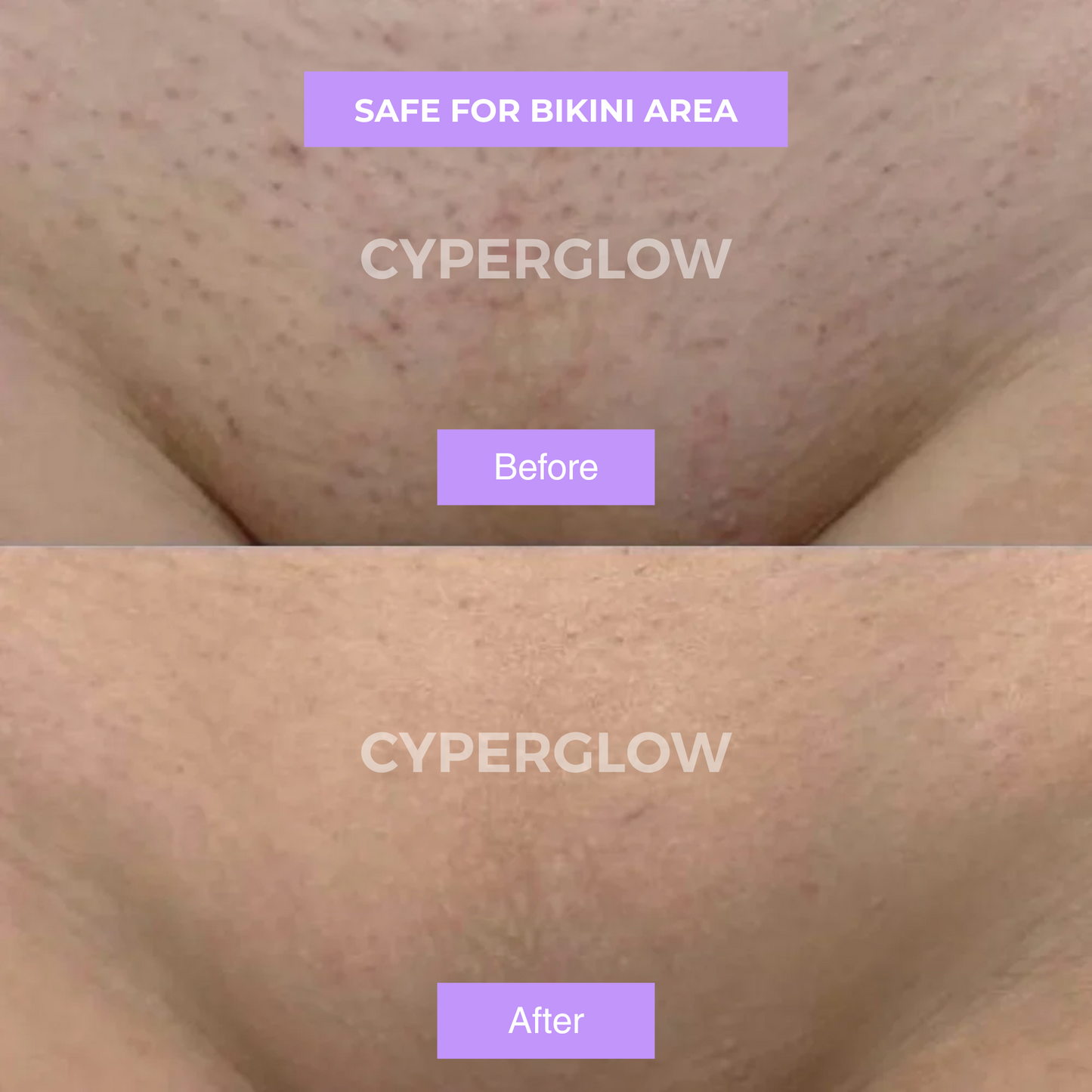 CyperGlow™ Premium Cyperus Rotundus Skin Serum For Radiant Glow