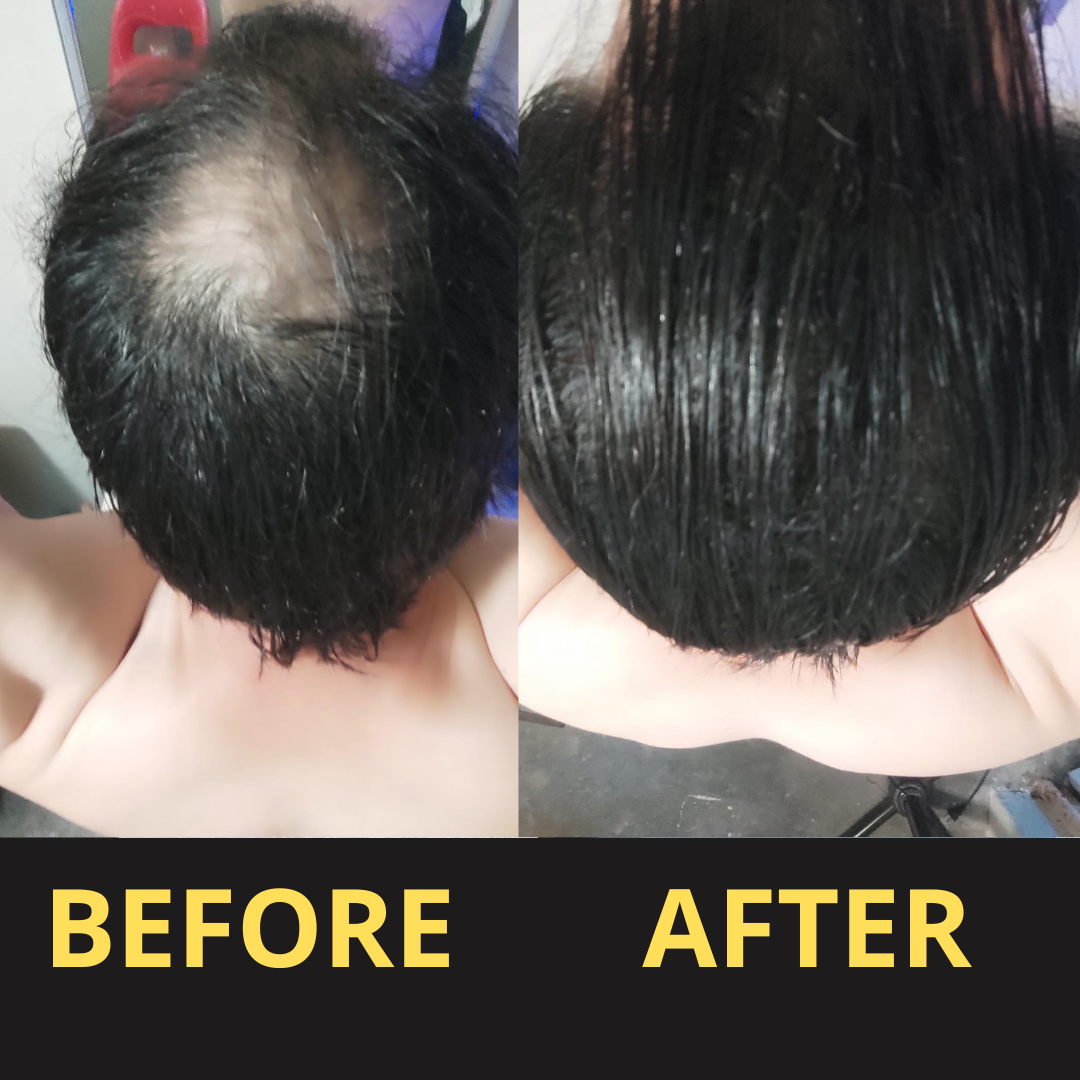 Hairfillup Waterproof Hair Concealer Black 50ml 3‑7 Day Coverage™