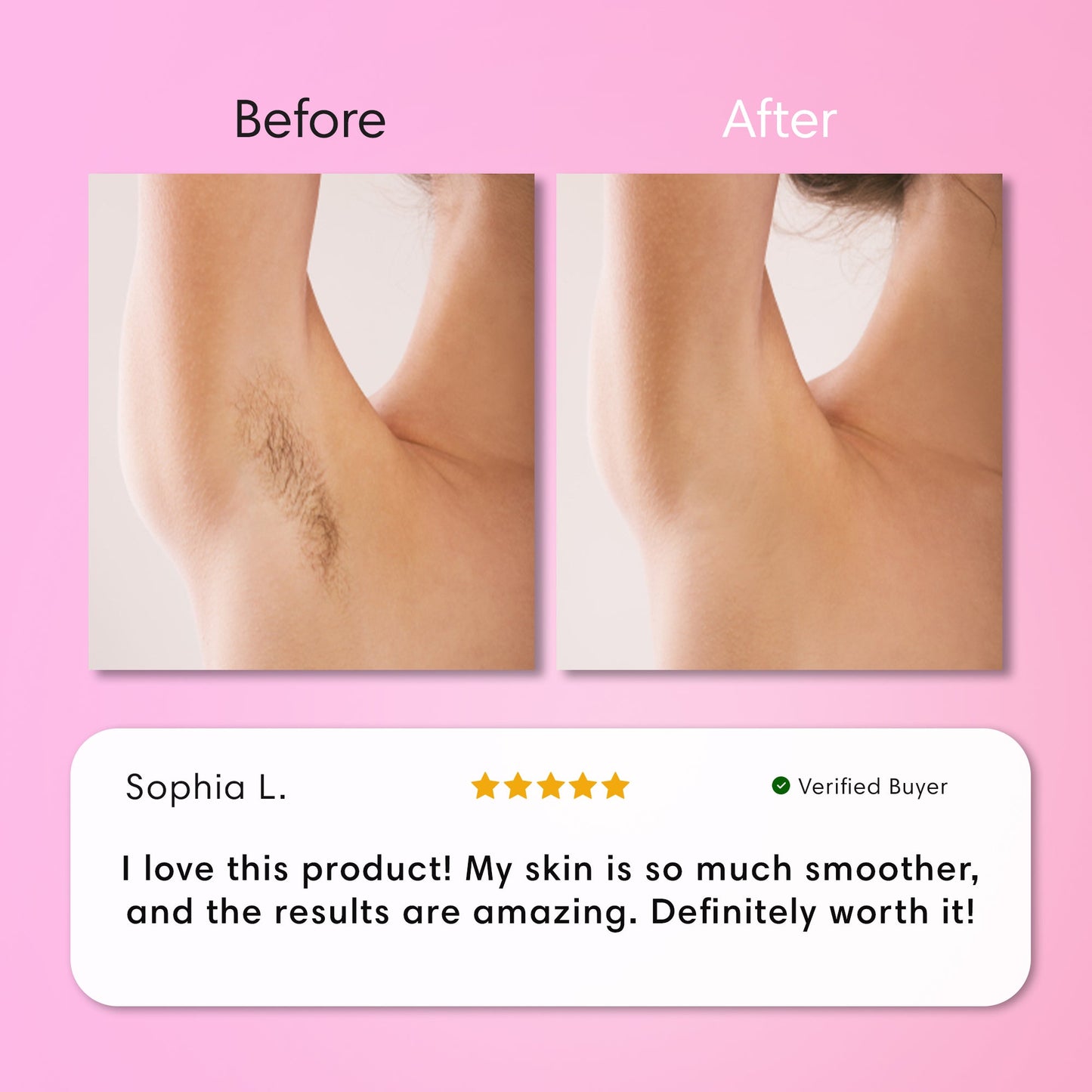 Aurlux™ Gentle Painless Body Hair Removal Cream for Silky Smooth Skin