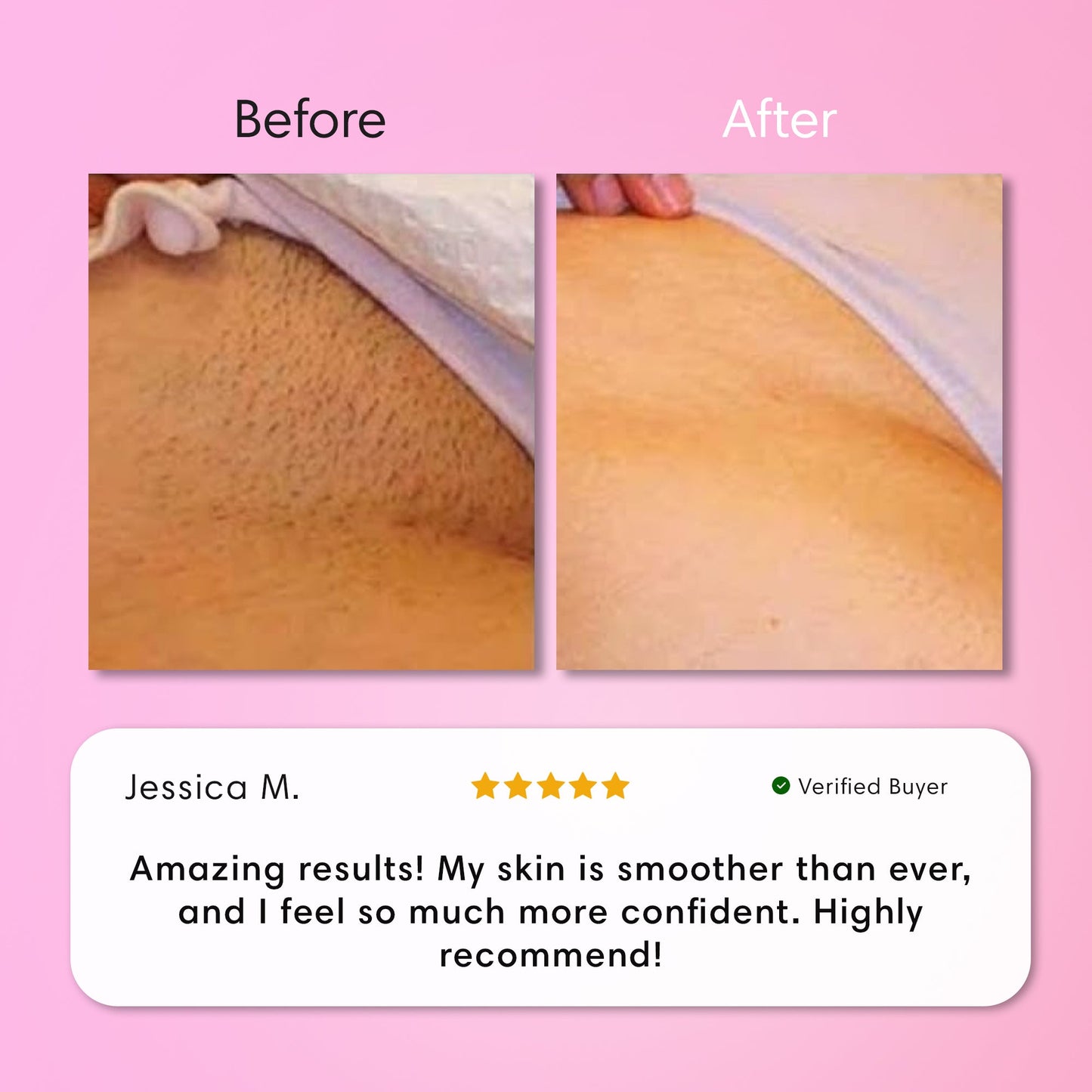 Aurlux™ Gentle Painless Body Hair Removal Cream for Silky Smooth Skin