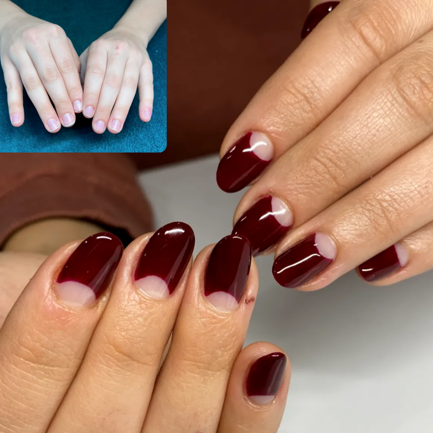 Revolutionary Stem Cell Nail Growth Treatment Pen for Stronger Healthier Nails™