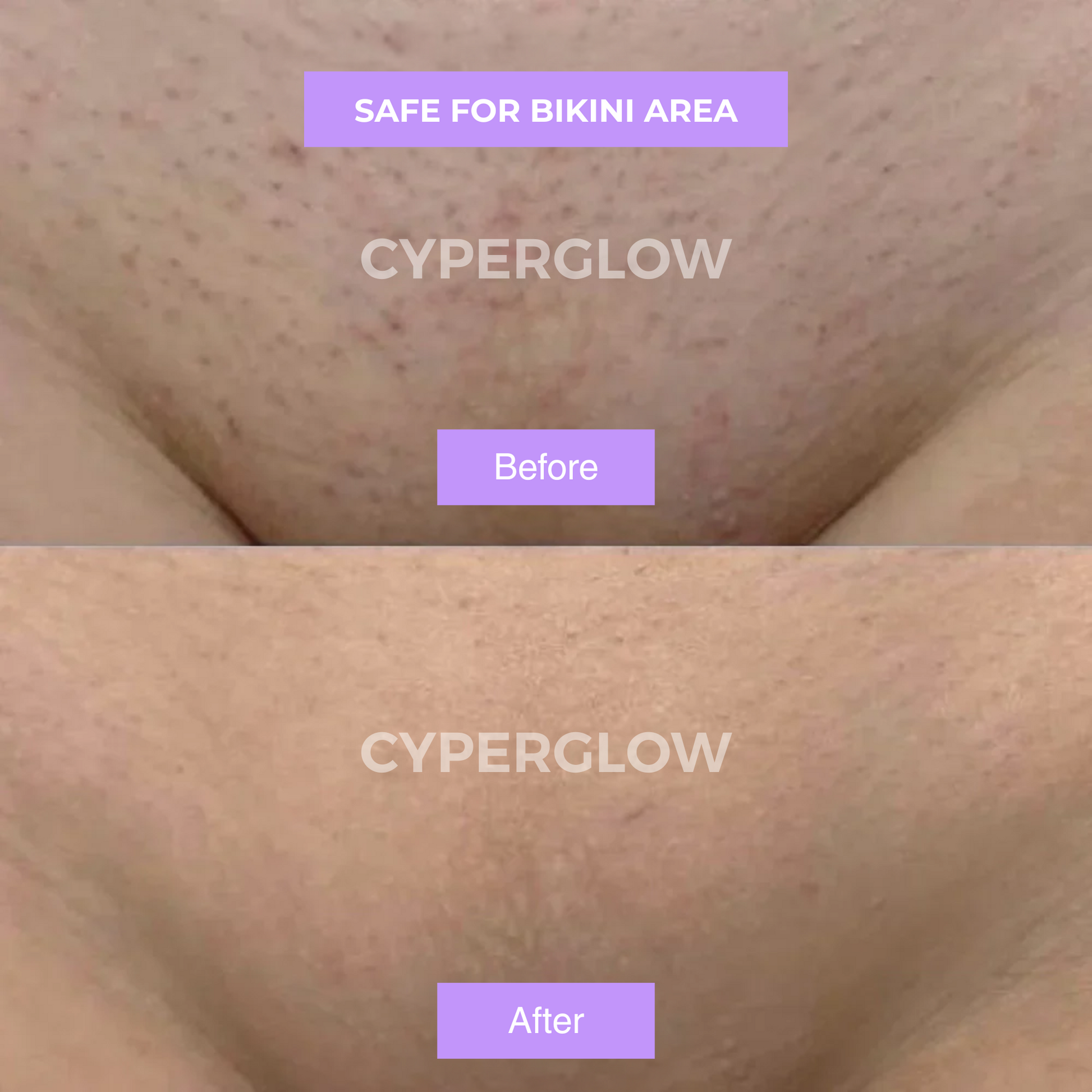 CyperGlow™ Premium Cyperus Rotundus Skin Serum For Radiant Glow