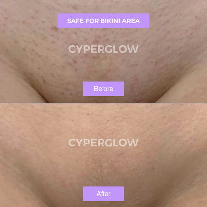 CyperGlow™ Premium Cyperus Rotundus Skin Serum For Radiant Glow
