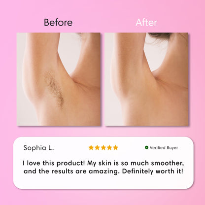 Aurlux™ Gentle Painless Body Hair Removal Cream for Silky Smooth Skin
