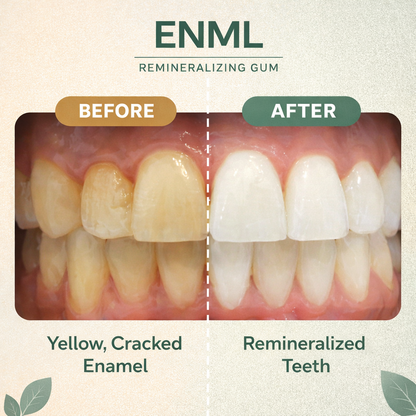 ENML™ Remineralizing Gum - Intense Mint